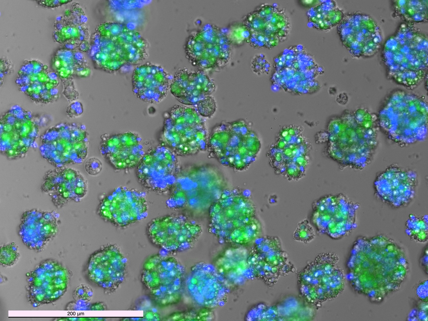 Fluorescence micrograph of differentiated cell aggregates in suspension, lipids stained green and nuclei blue.